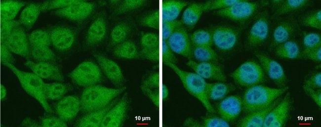 Anti-CIAPIN1