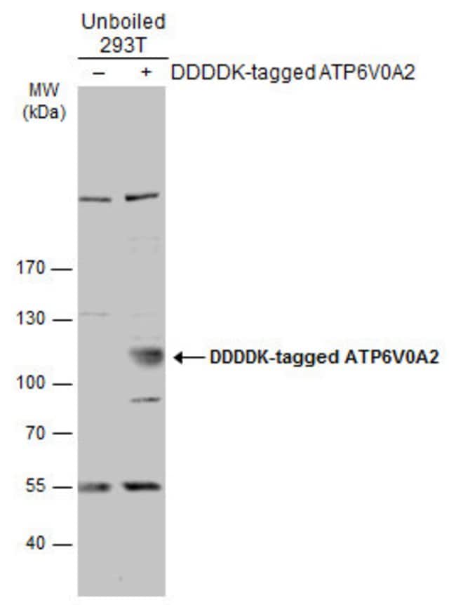 Anti-ATP6V0A2