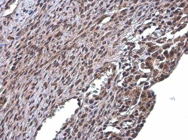 Anti-RSK2