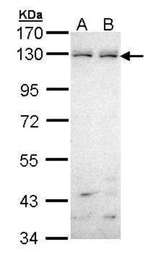 Anti-Eph receptor B6