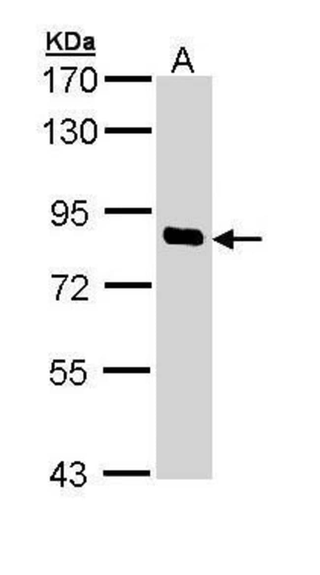 Anti-SCYL1