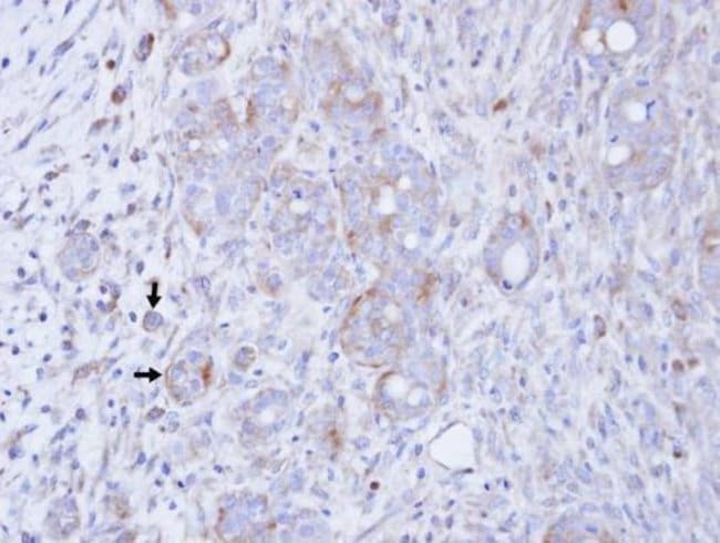 Anti-DAG kinase gamma