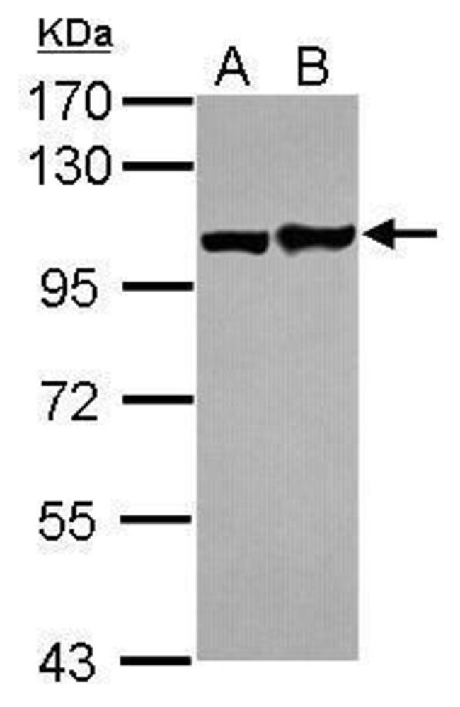 Anti-Eph receptor A1