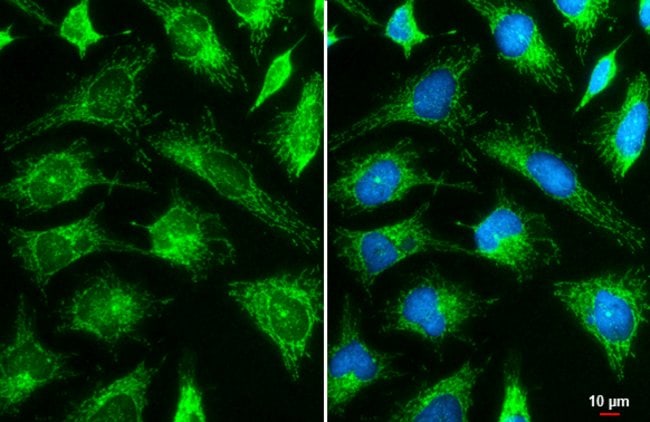 Anti-Hexokinase II