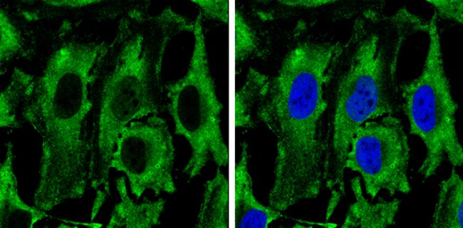 Anti-Pyruvate Kinase (muscle)