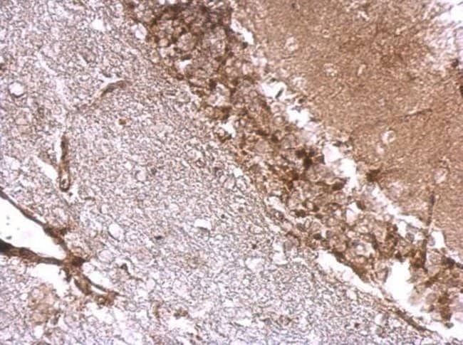 ANTI-DREBRIN