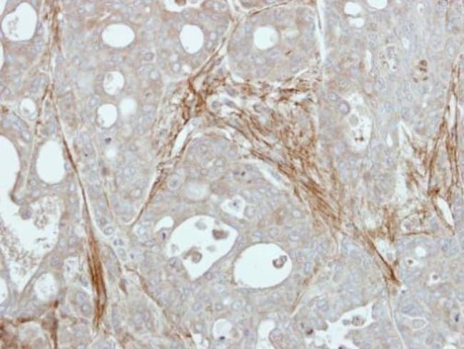 ANTI-FIBULIN 3
