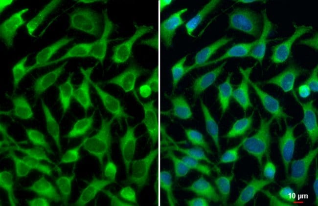 Anti-insulin degrading enzyme