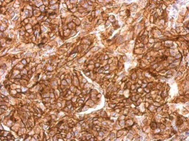 Anti-CD10
