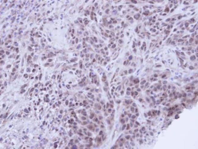 Anti-XRCC1