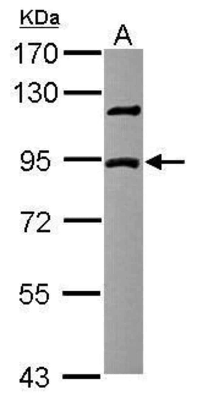 Anti-DCBLD2