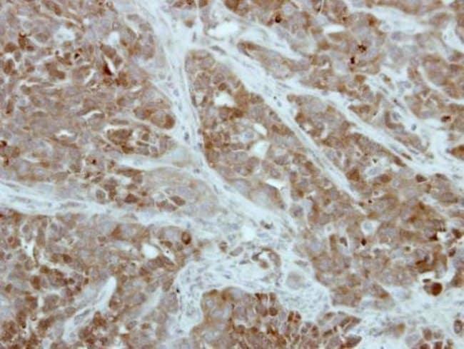 Anti-PFKFB1