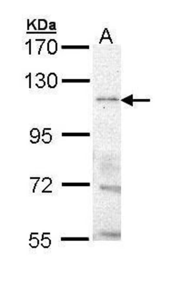 Anti-Trp-p8