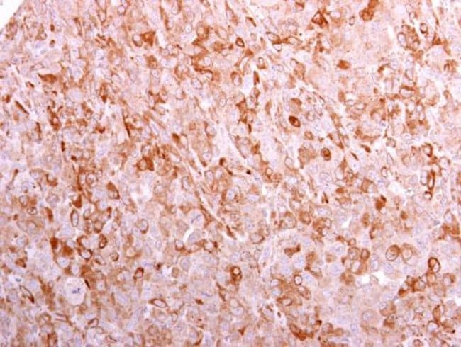 Anti-CD3 gamma