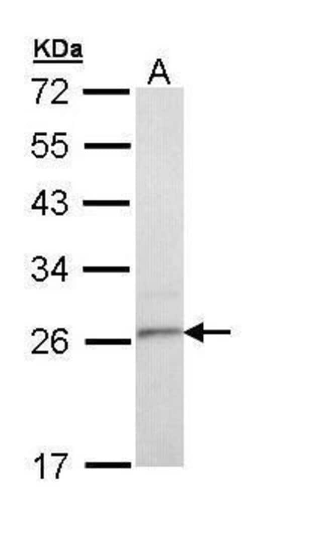 Anti-Tetraspanin-6