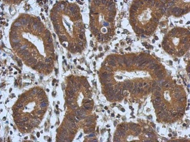 Anti-NOL3