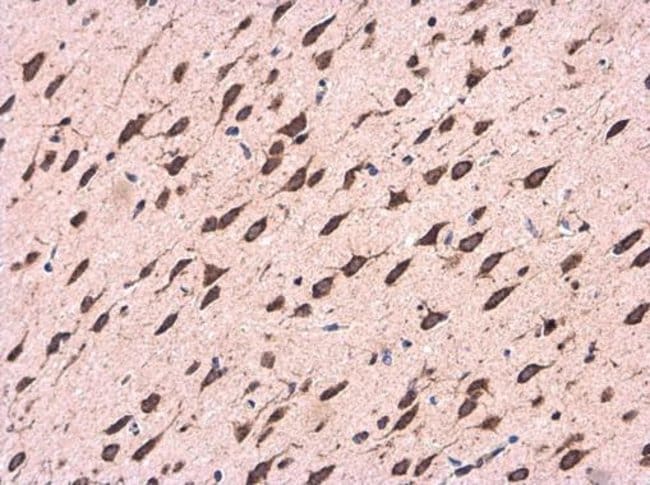 Anti-CDK5RAP1