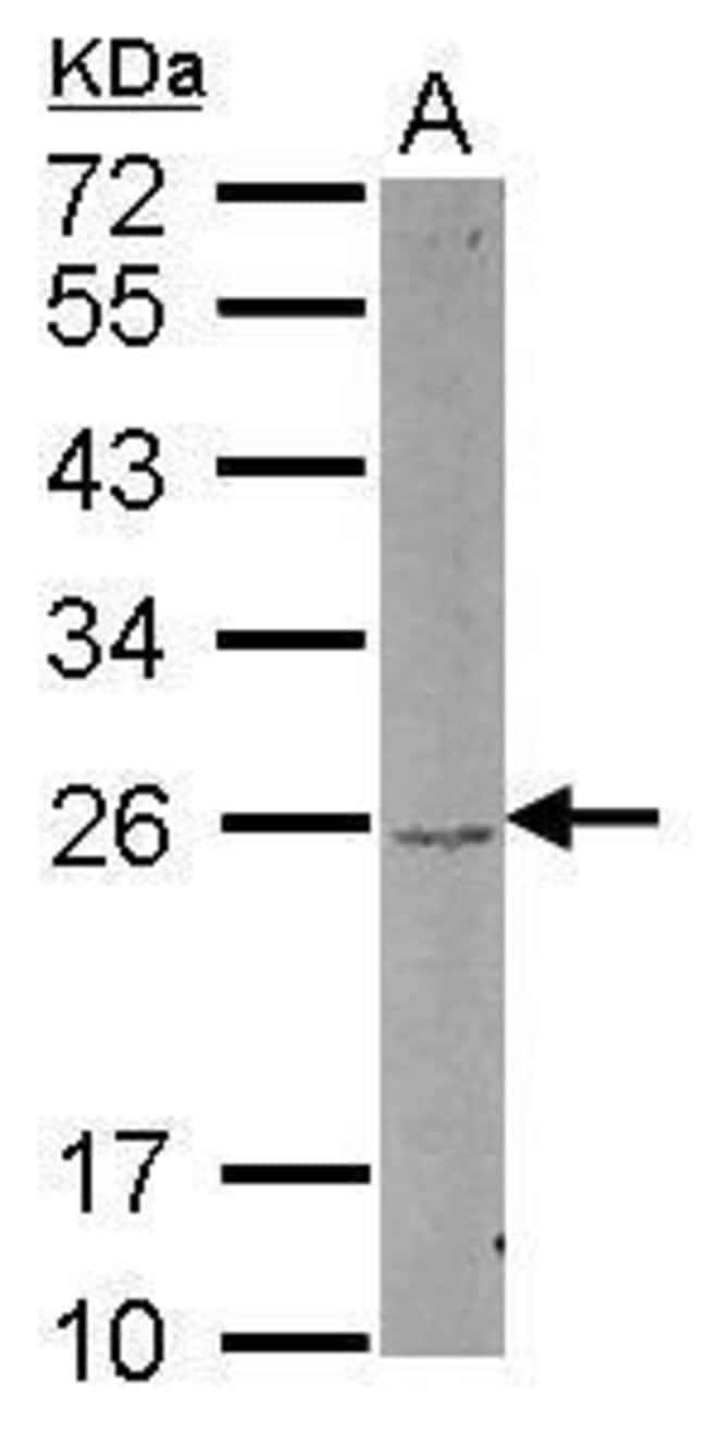 Anti-DUSP22
