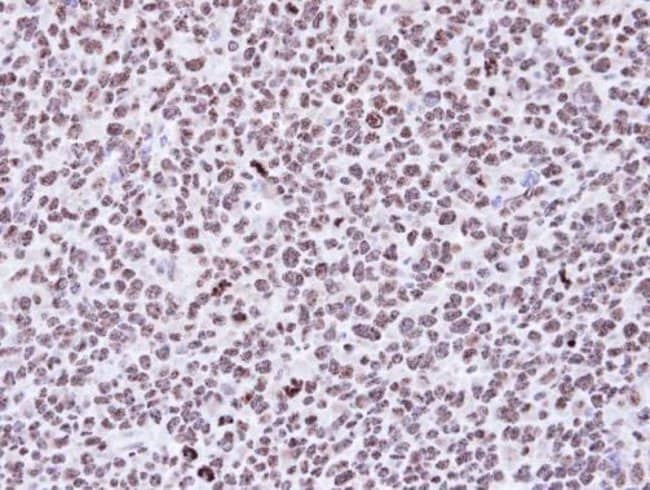 Anti-p53DINP1