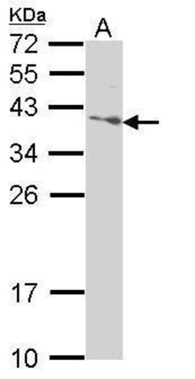 Anti-SAP30BP