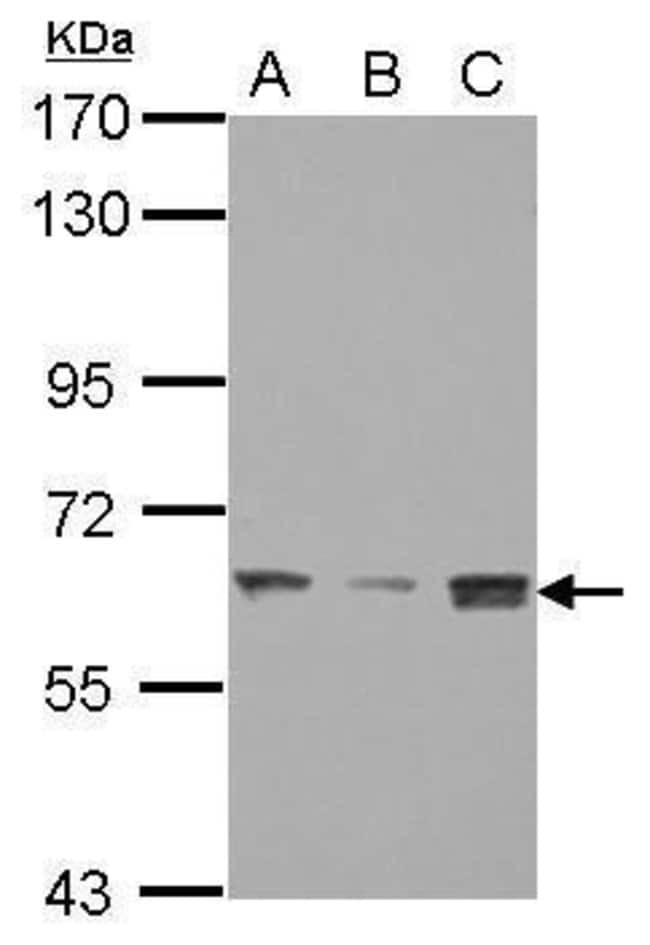 Anti-SMARCD3