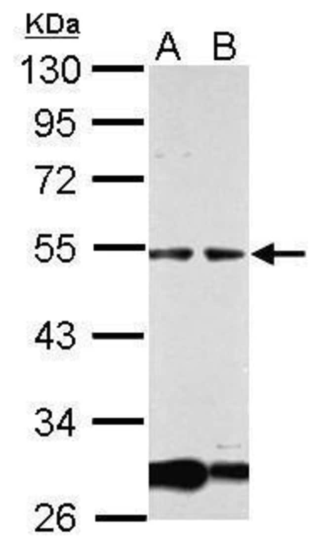 Anti-GCM1