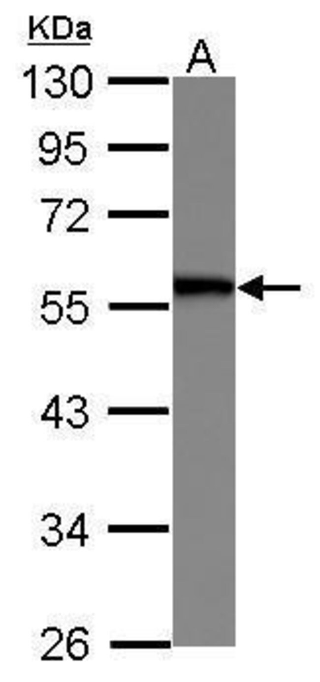 Anti-SERBP1