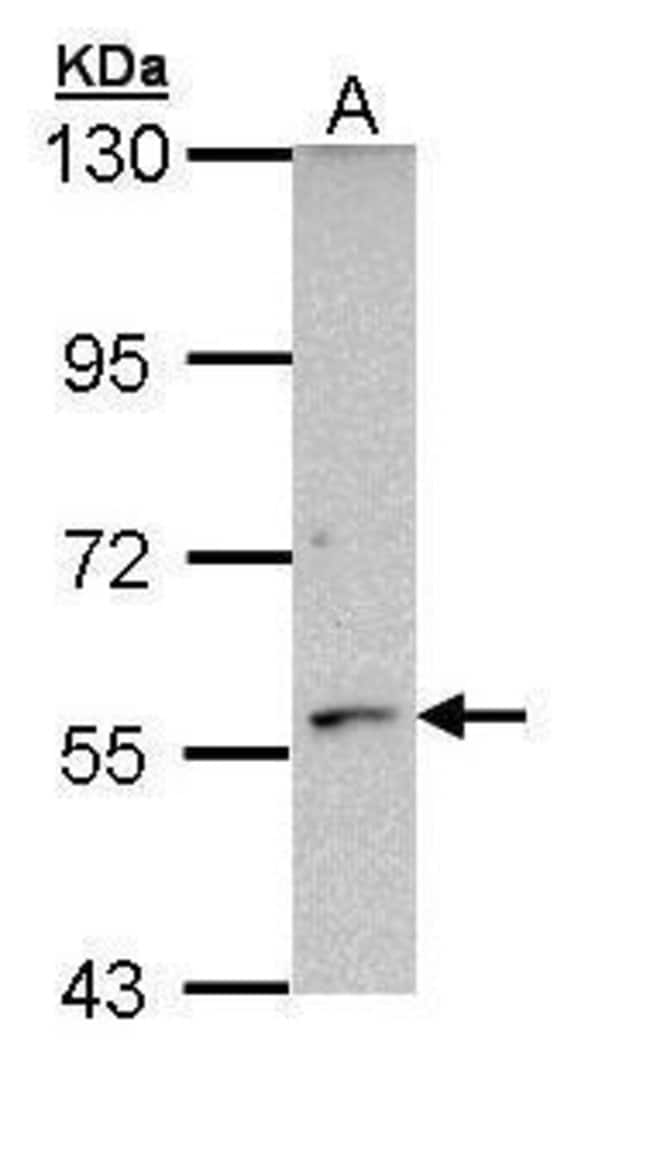 Anti-CYP21A2