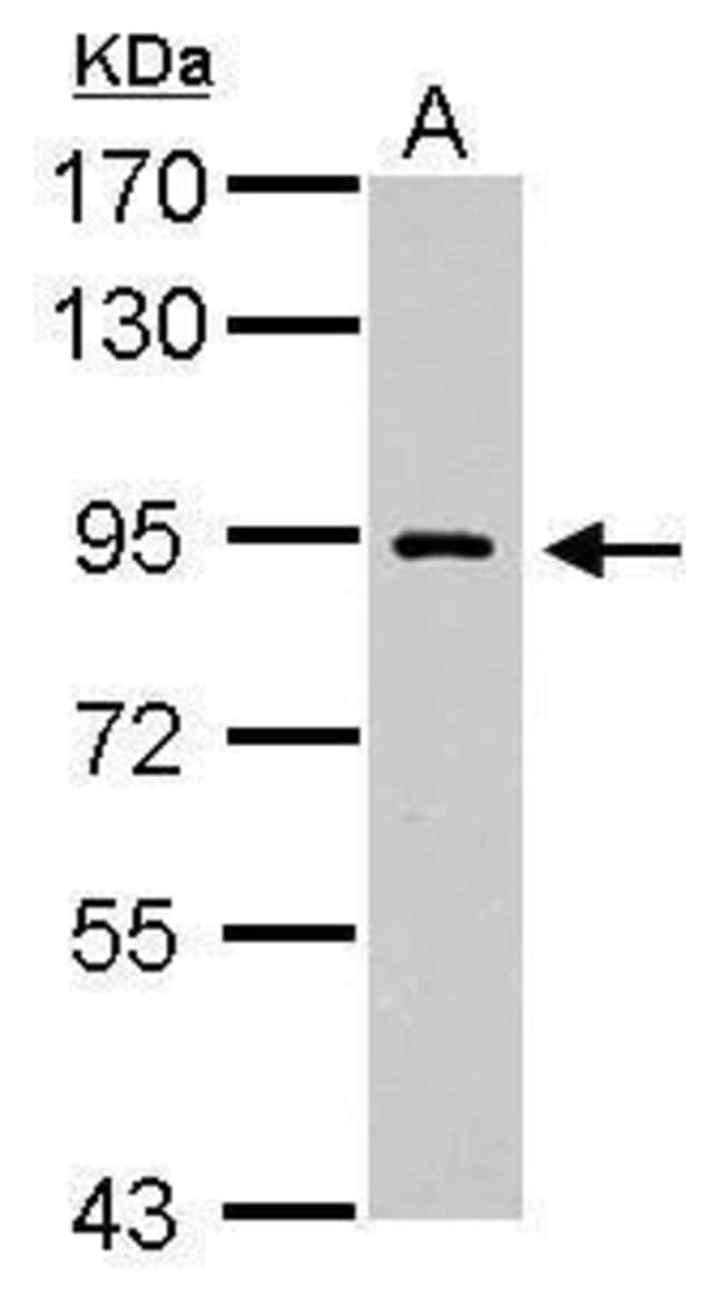 Anti-DNA polymerase iota