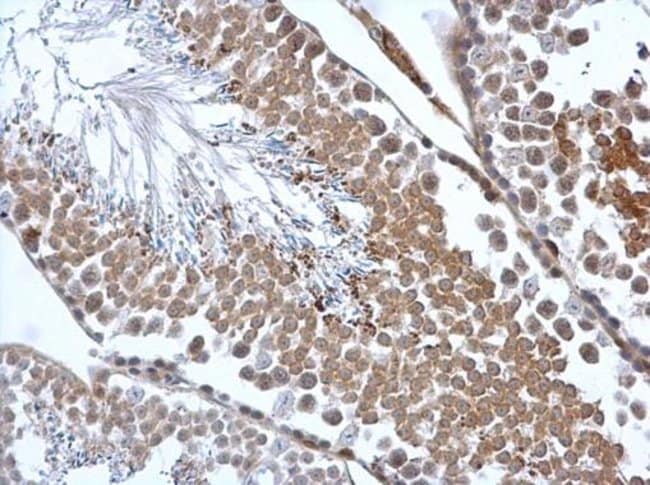 Anti-Calreticulin 3