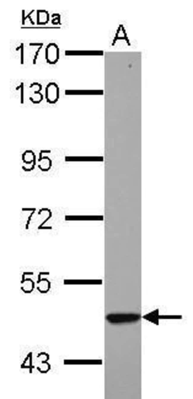Anti-KRT23