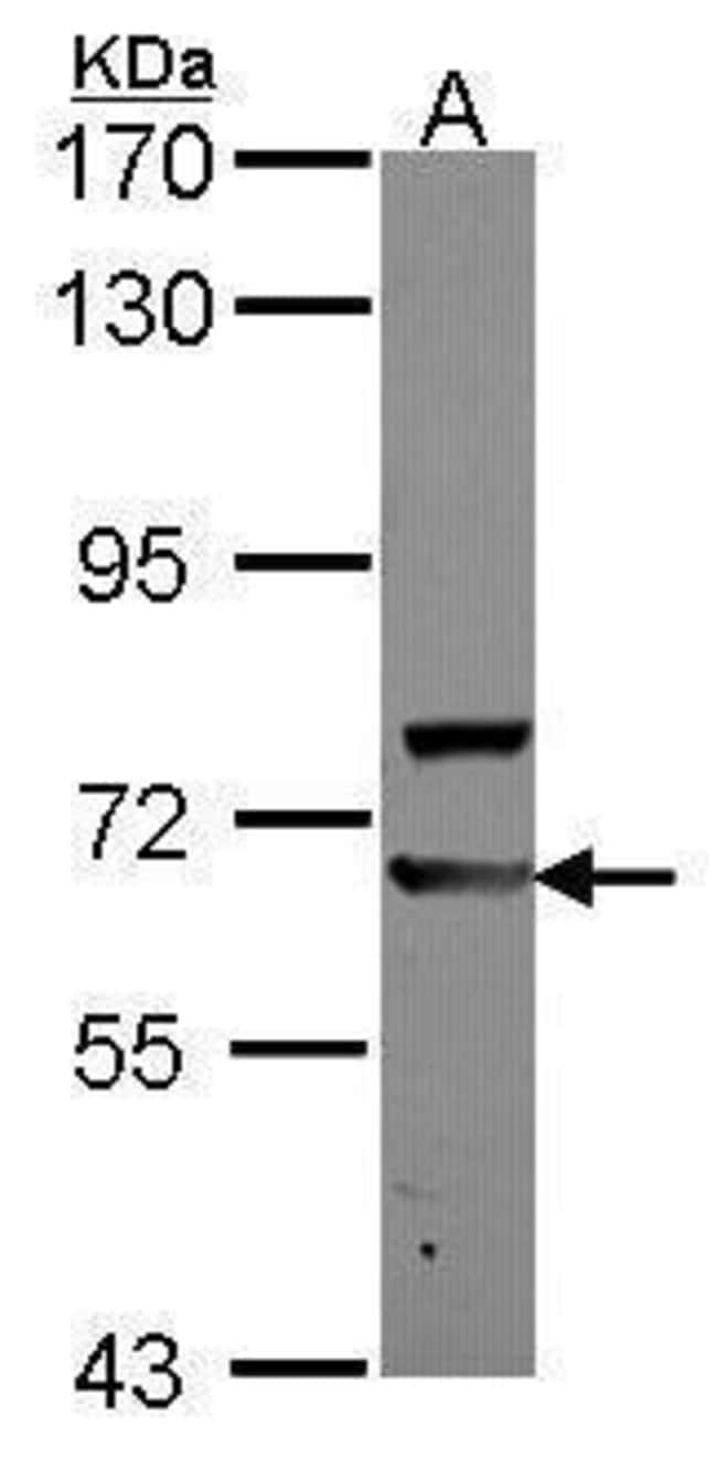 Anti-AdoHcyase 2