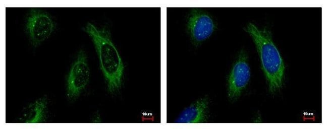 Anti-Cytokeratin 4