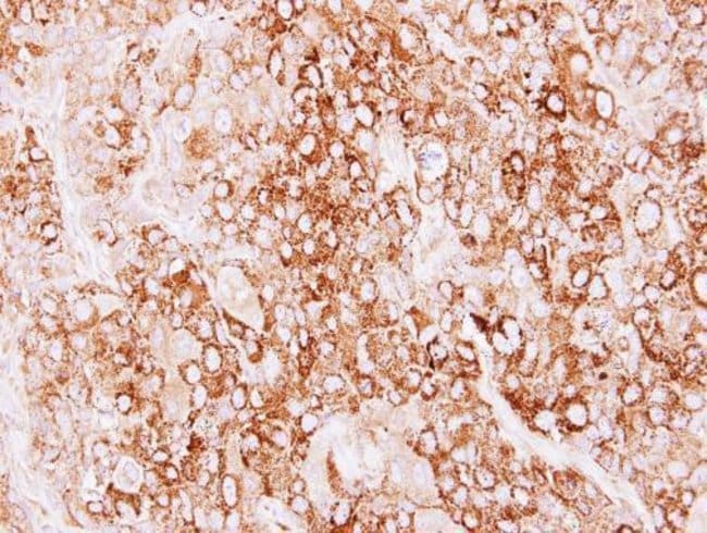 Anti-Creatine kinase MT