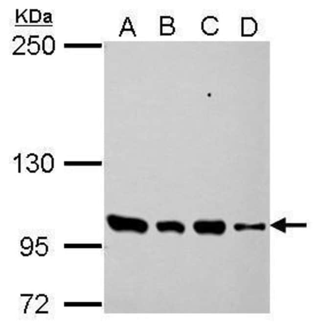 Anti-PDE3A