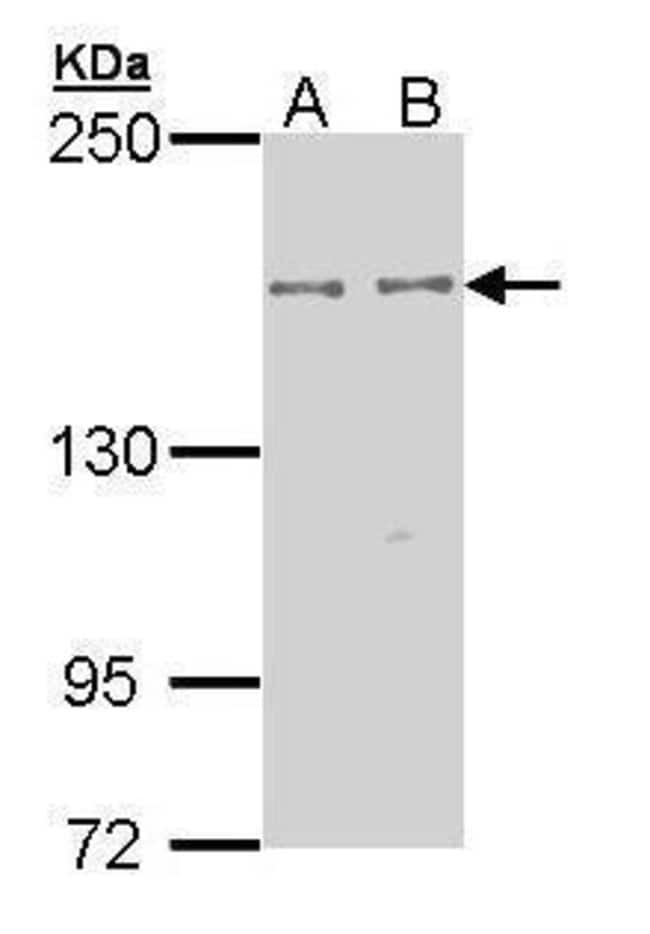 Anti-EPB41L2