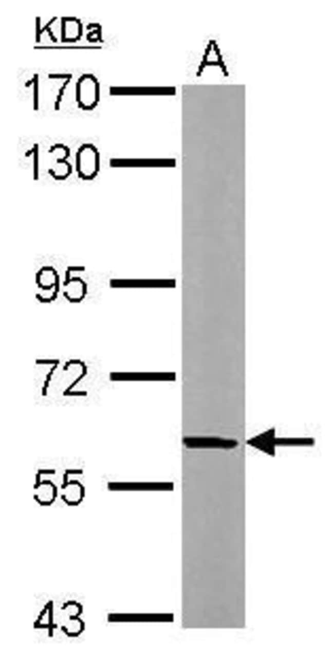 Anti-beta Adducin
