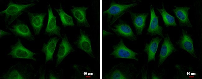 Anti-HMGCS1