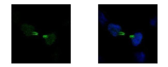 Anti-KIF22