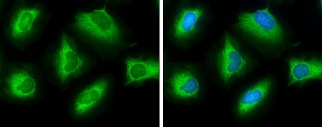 Anti-ATP citrate lyase