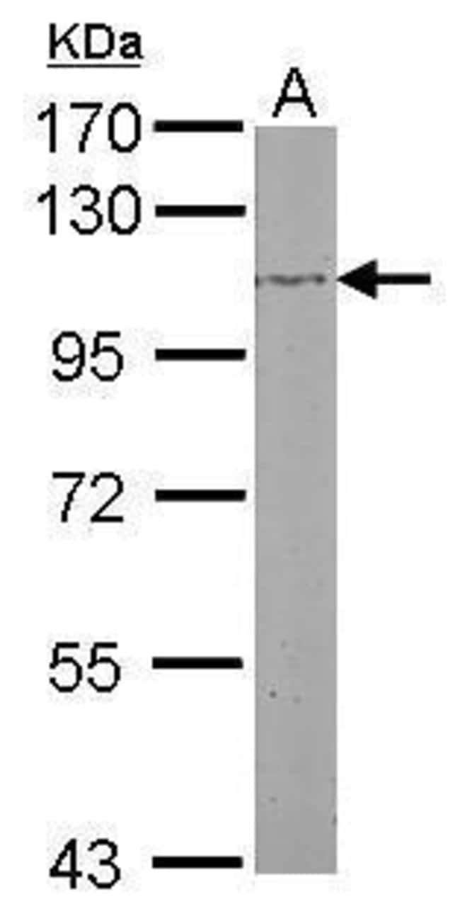 Anti-beta Adducin