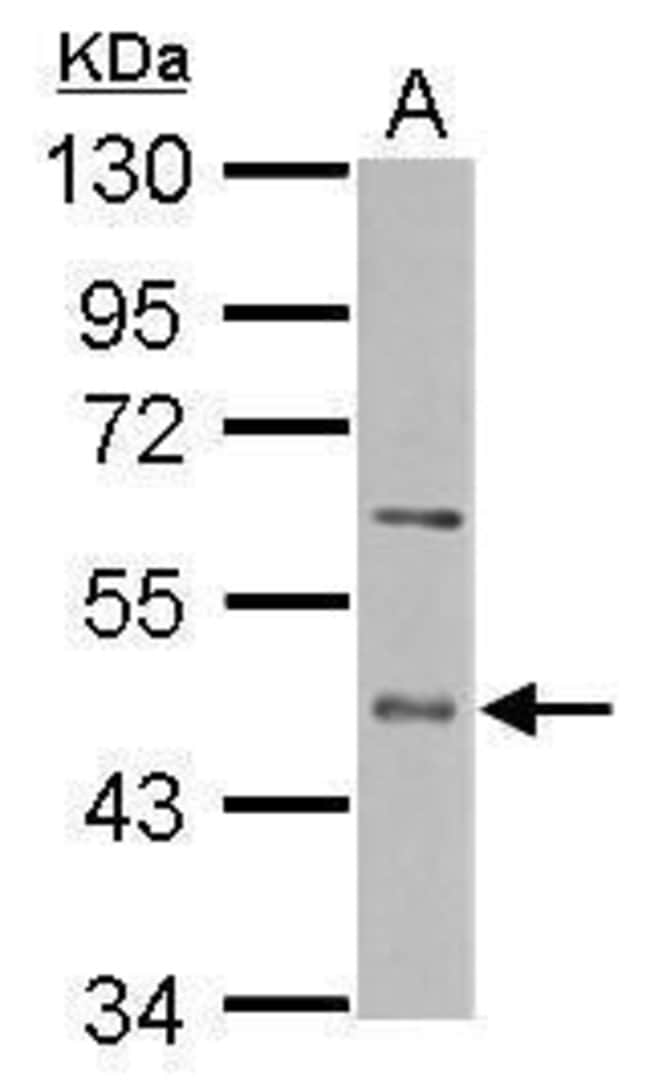 Anti-ENTPD5