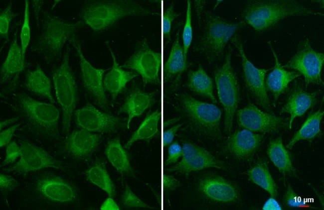 Anti-ACSL3