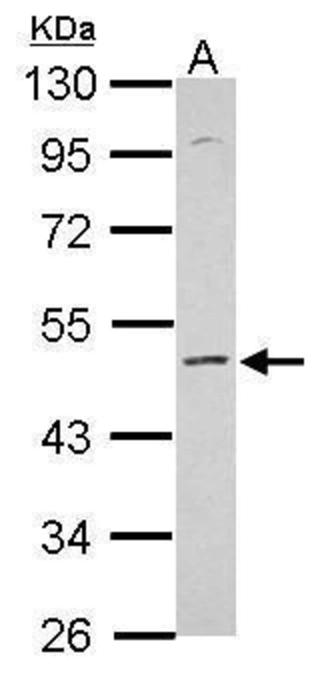 Anti-KCNS2