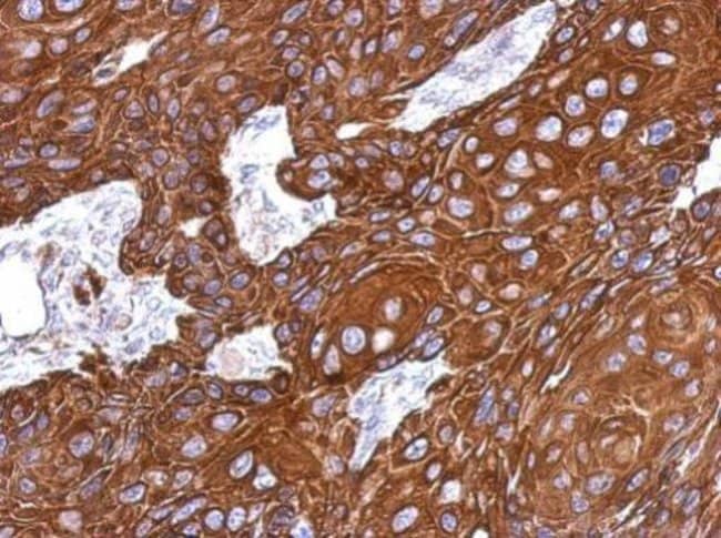 Anti-Cytokeratin 33B