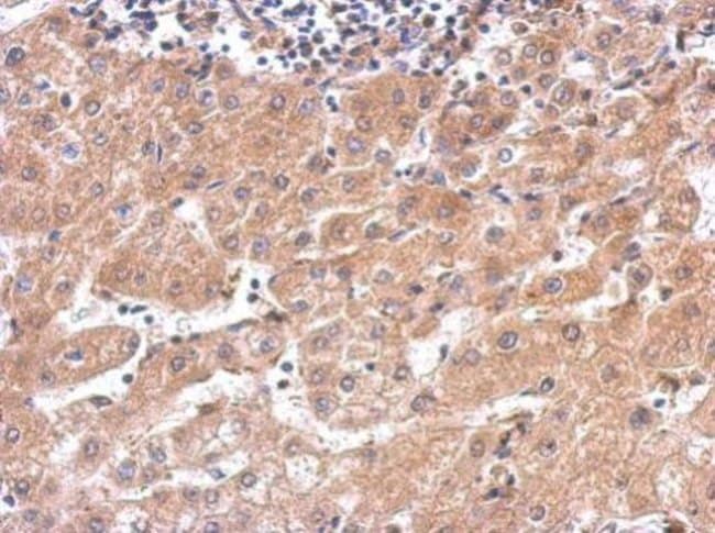 Anti-alanyl-tRNA synthetase