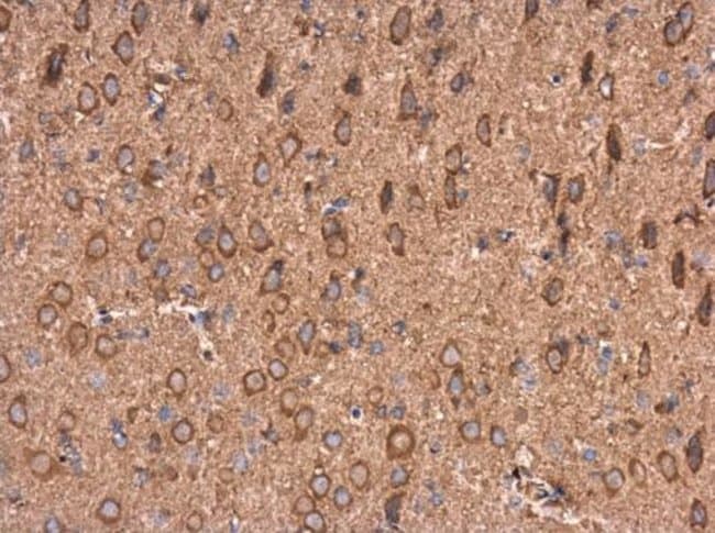 Anti-AMPD2