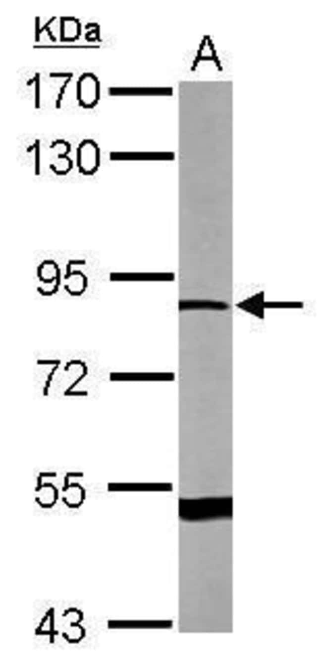 Anti-DRP2
