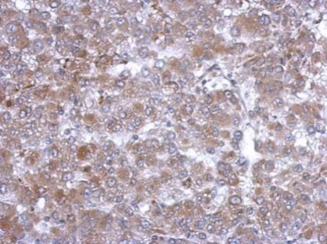 Anti-Hemopexin