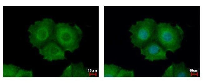 Anti-Cytokeratin 31